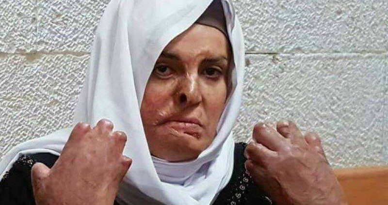 Isaa Jaabis, the face of normalization, medically neglected in an Israeli prison, Picture soure: Middle East Monitor
